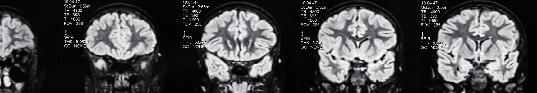 Clinical Neurosciences