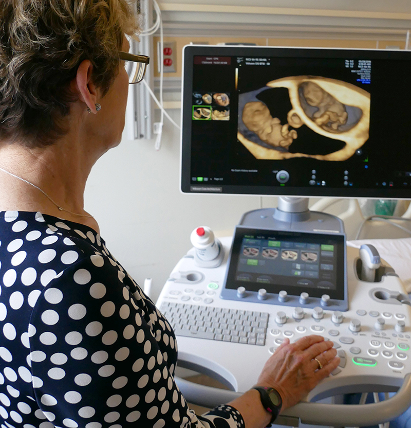 Women's Ultrasounds