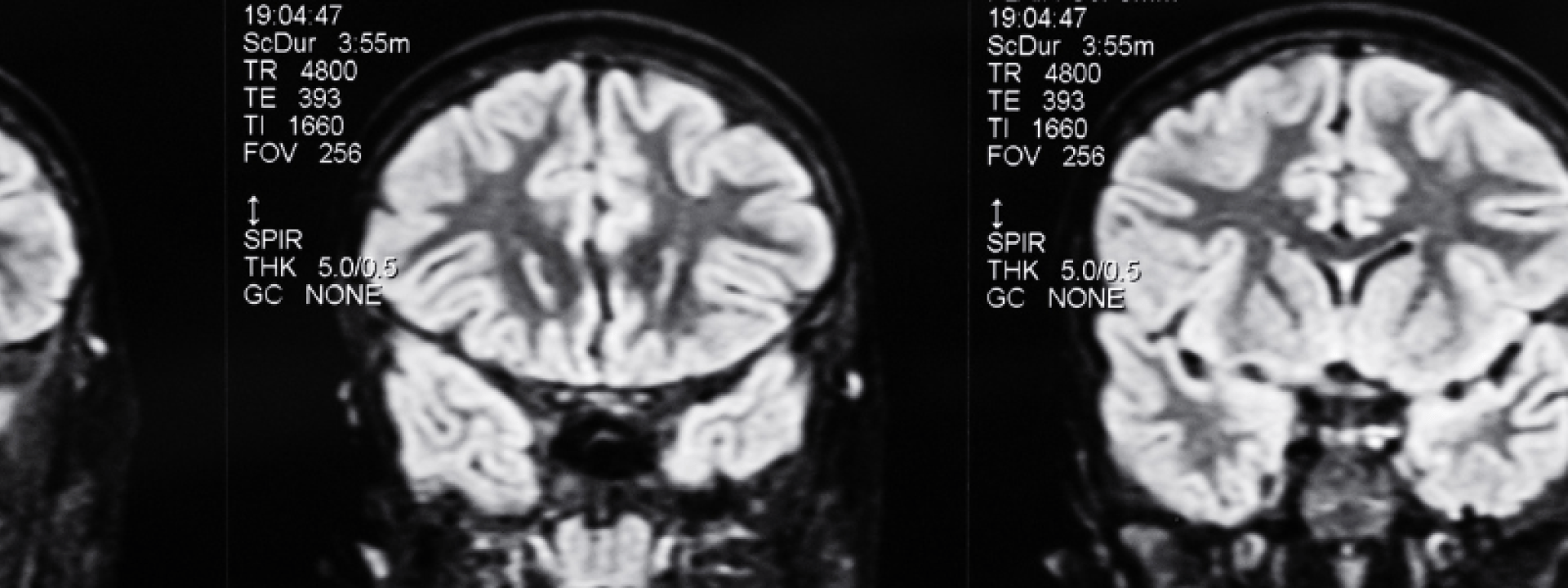 Clinical Neurosciences