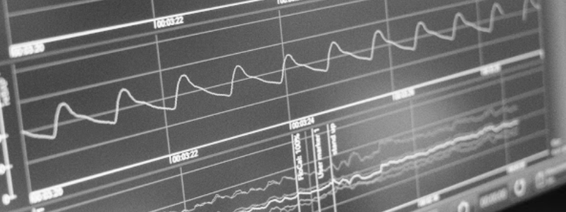 Cardiac Care