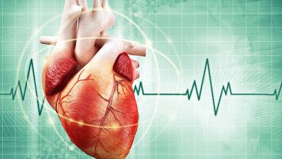 Arrhythmia